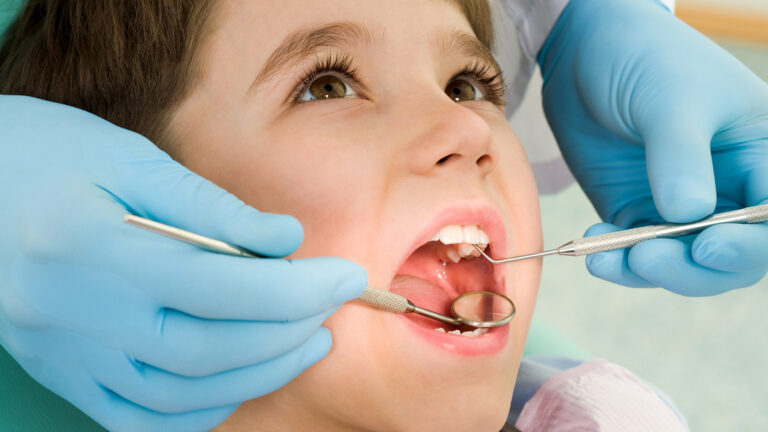 child getting checked for cavities